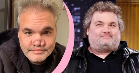 Here’s What Happened to Artie Lange’s Nose